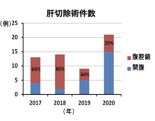 肝切除手術件数